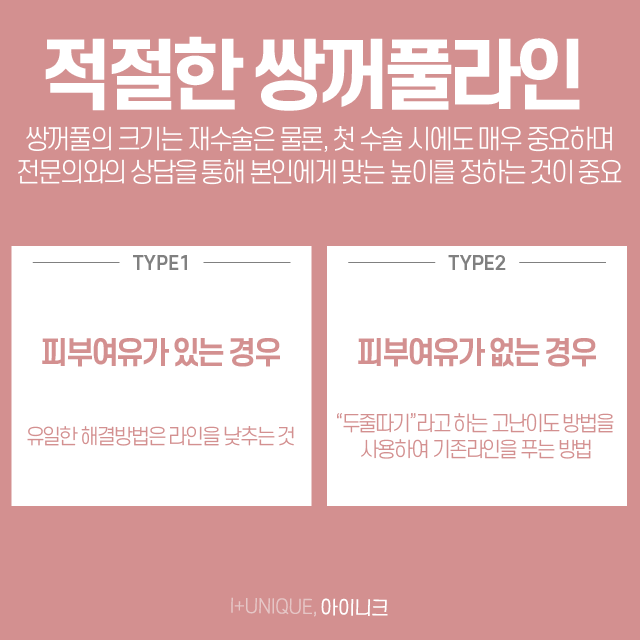 거울 볼 때마다 속상한 내 눈, 쌍커풀재수술병원에서 알아보자 관련 이미지 3