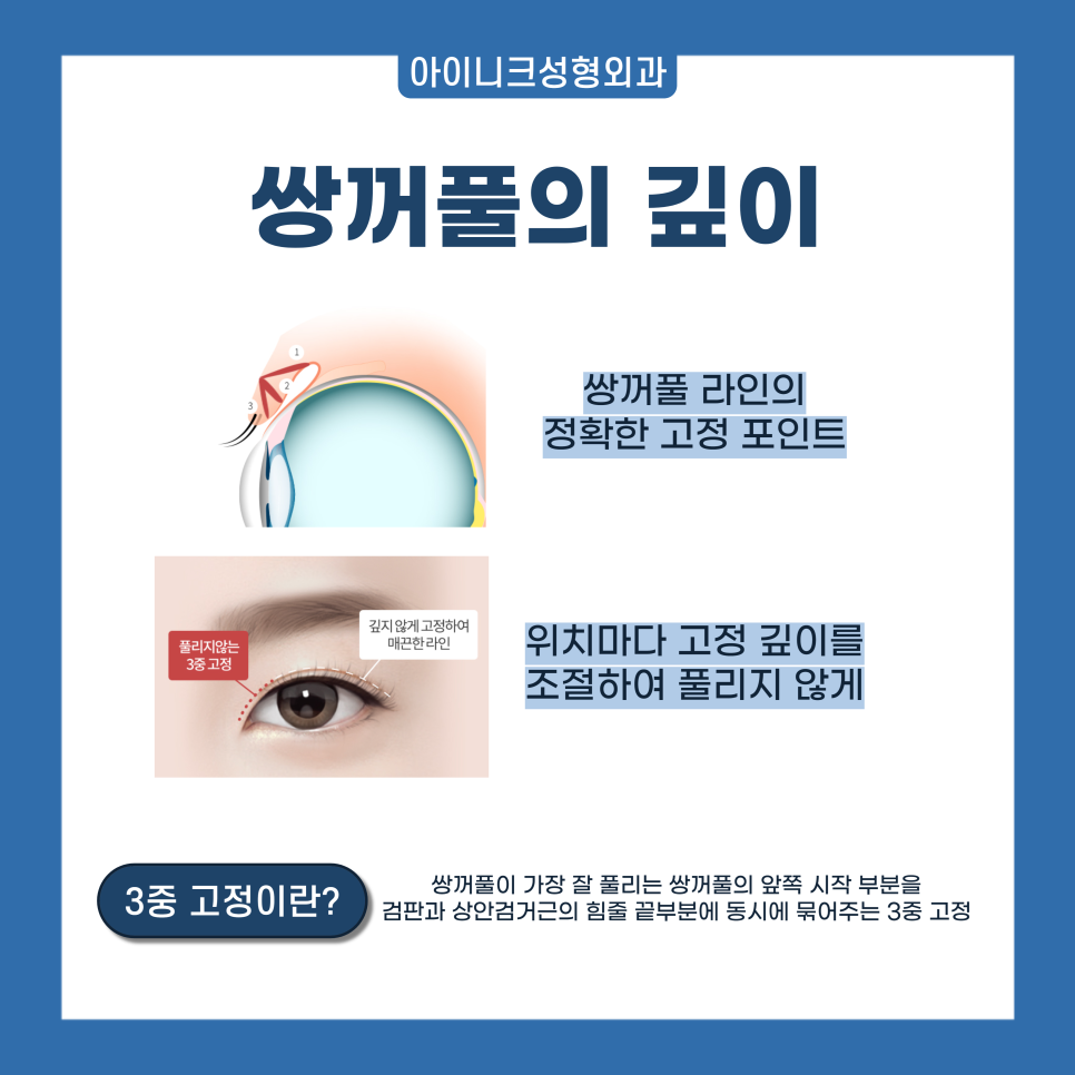 Where to Get Natural and Skillful Eyelid Surgery in Gangnam image 4