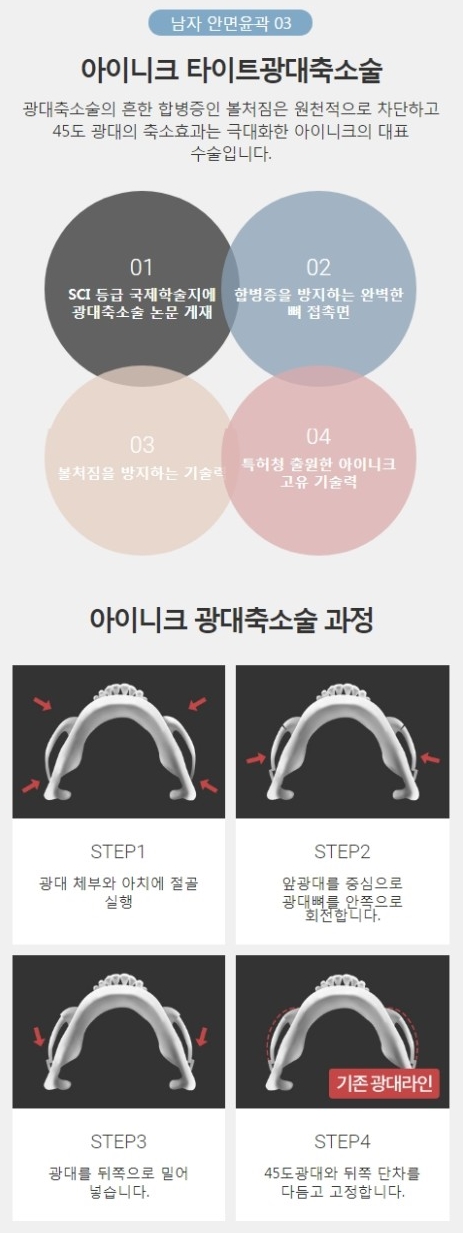 남자양악수술가격 비율에 맞는 자연스러운 라인! 관련 이미지 5