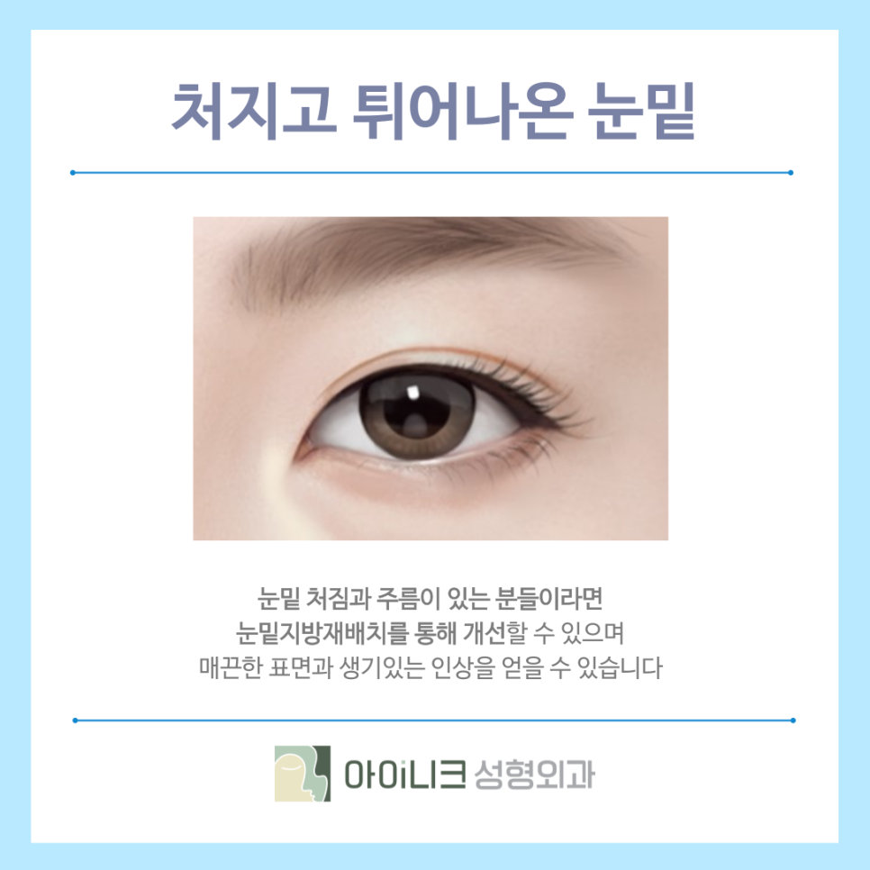 신사역근처눈밑지 동안 페이스로 만들기 관련 이미지 3