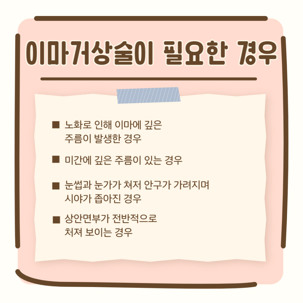 이마거상유명한곳, 이것이 달라요! 관련 이미지 4