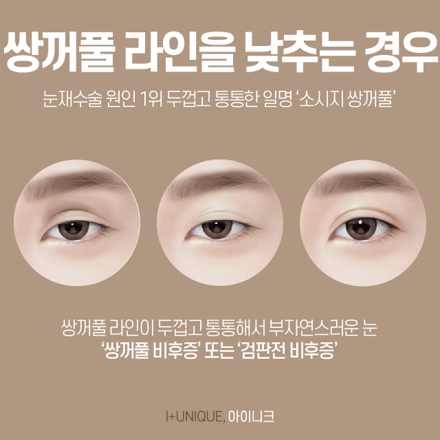 How Can Double Eyelid Line Reduction Be Done? image 2