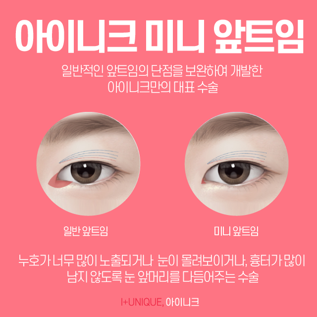 앞트임잘하는곳 아이니크에서 알려주는 수술방법 관련 이미지 4