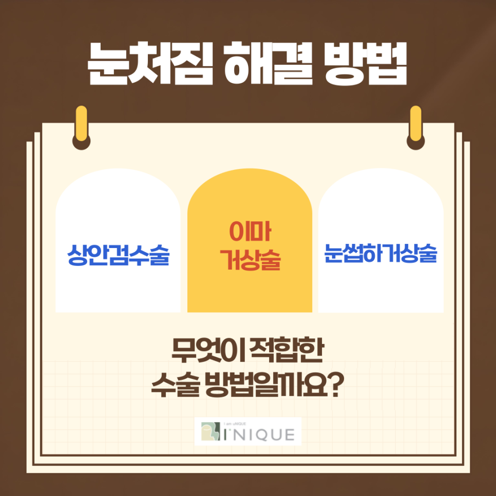 중년남성눈성형도 자신있게! 관련 이미지 3