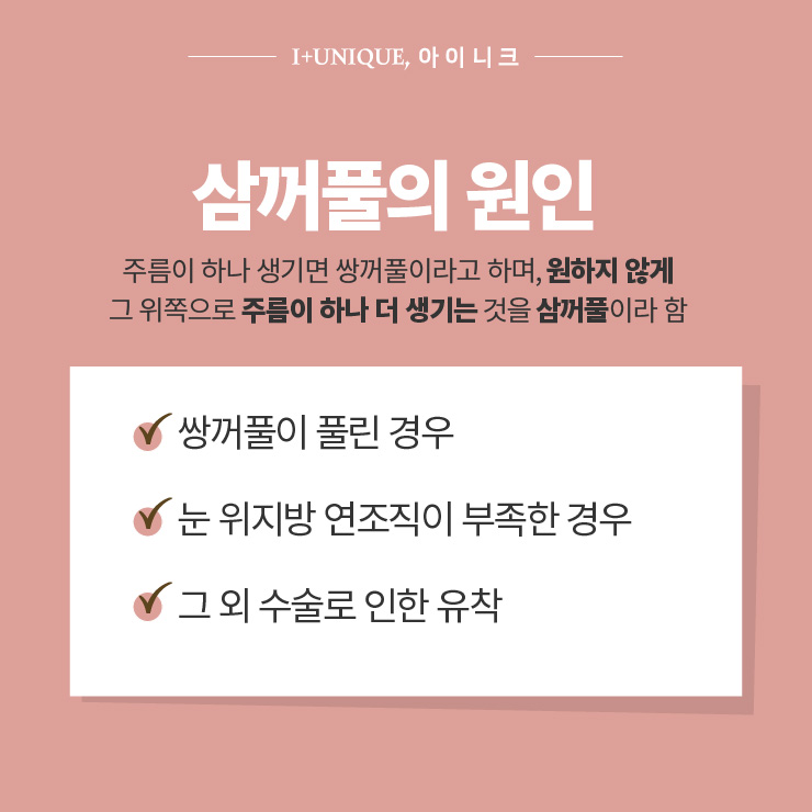 쌍꺼풀이 여러겹? ㅇㅇㄴㅋ에서  삼꺼풀 탈출하기 #1 관련 이미지 2