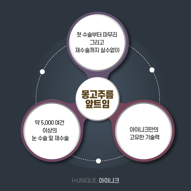 몽고주름앞트임 여기로 결정하자. 관련 이미지 5
