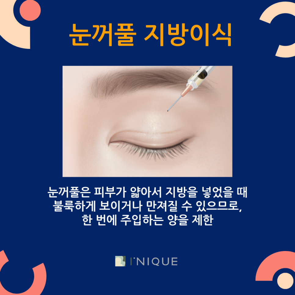 쌍꺼풀 여러겹 해결 하고 싶다면? 관련 이미지 6