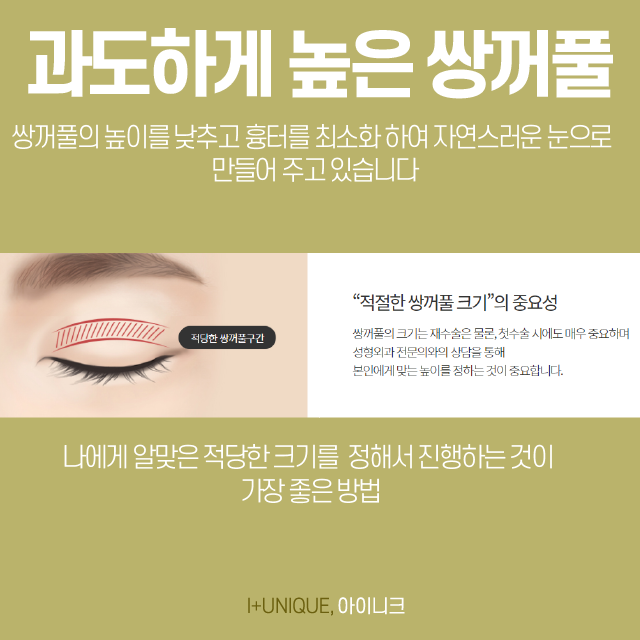 쌍수재수술병원을 고를 땐 의사의 실력이 중요합니다 관련 이미지 3