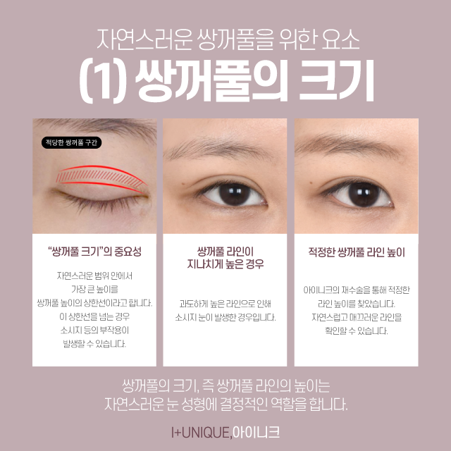 남자눈성형잘하는곳을 찾고 있다면? 관련 이미지 3