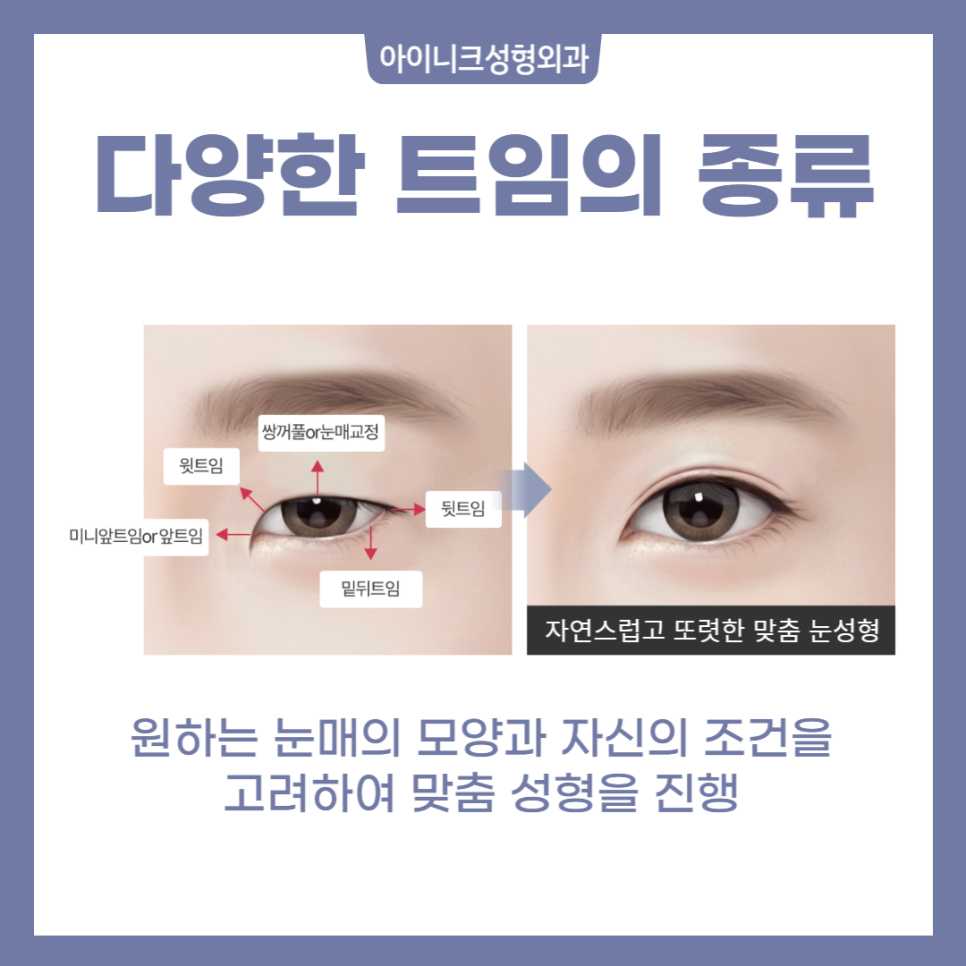 Full Eye Corners, Various Types! image 2