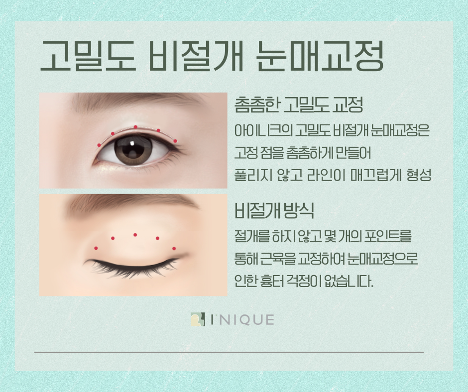 눈매교정잘하는곳 궁금하다면? 관련 이미지 4