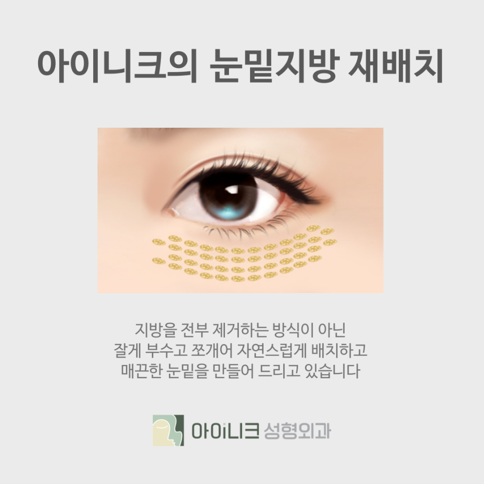 Improving with Under-Eye Fat Repositioning at Sinsa Station image 5