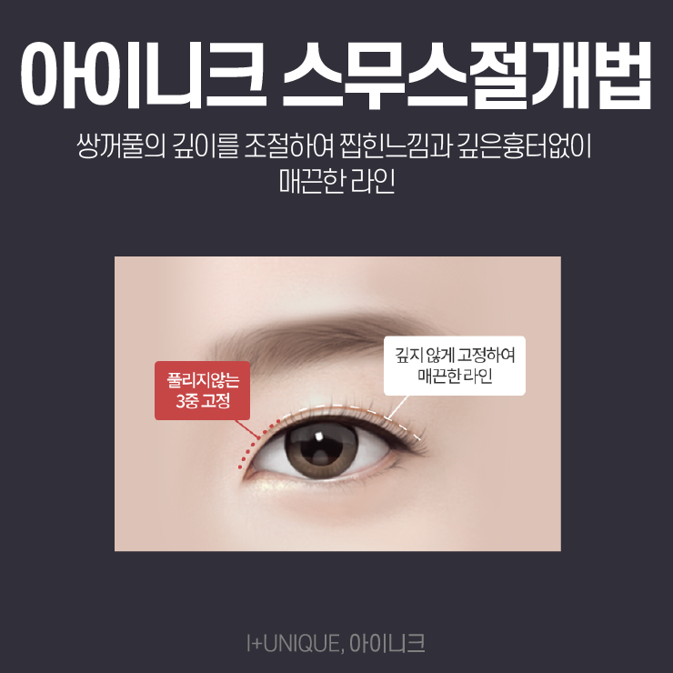 강남눈성형을 알아보고 있다면 주목해야할 성형외과 아이니크! 관련 이미지 3