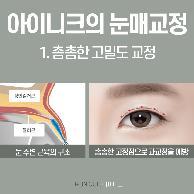 흐릿한 눈매가 고민인 여자분들, 비절개 눈매교정술 상담 받으세요! 관련 이미지 3