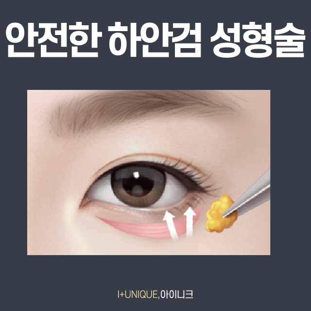 나! 다시 돌아갈래~ 중년 눈 성형, 눈썹거상술 관련 이미지 5