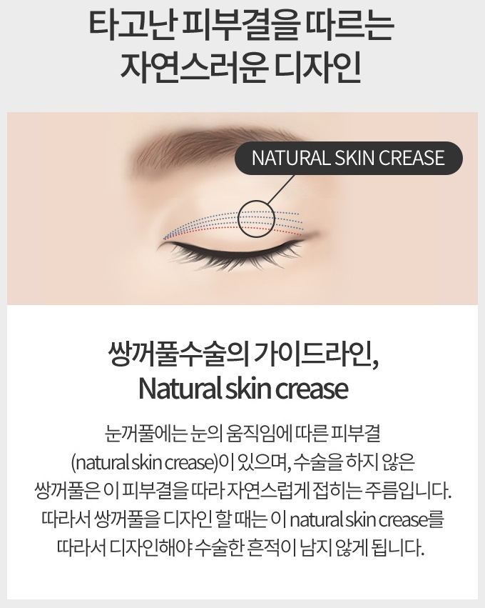 인아웃라인쌍꺼풀 예쁘고 자연스럽게 관련 이미지 6