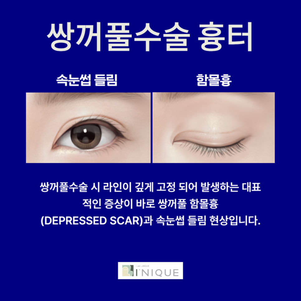 Why Do Double Eyelid Scars Occur? image 2
