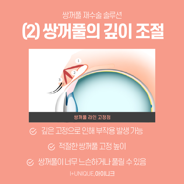 흉터,재수술이 필요하다면 강남쌍꺼풀재수술 잘하는곳 아이니크에서! 관련 이미지 4