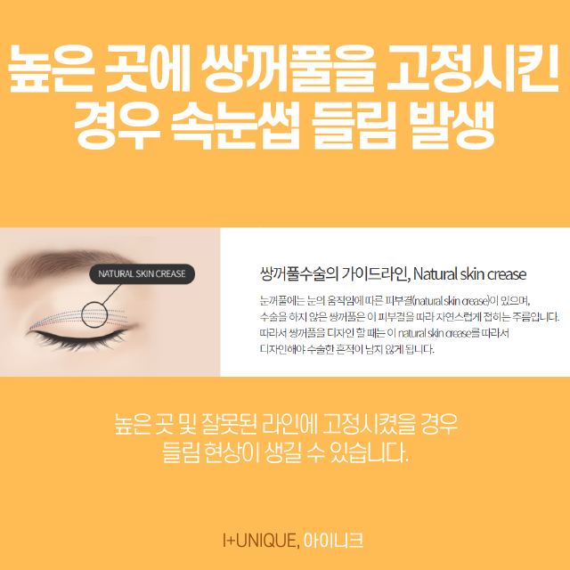 속눈썹들림 - 달라진 눈 모양 해결하기 관련 이미지 4