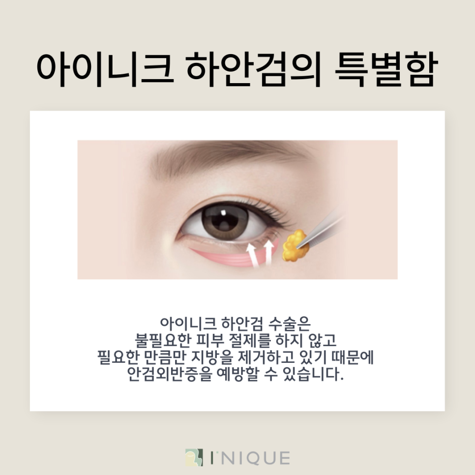 When You're Looking for a Natural Under-Eye Correction image 5