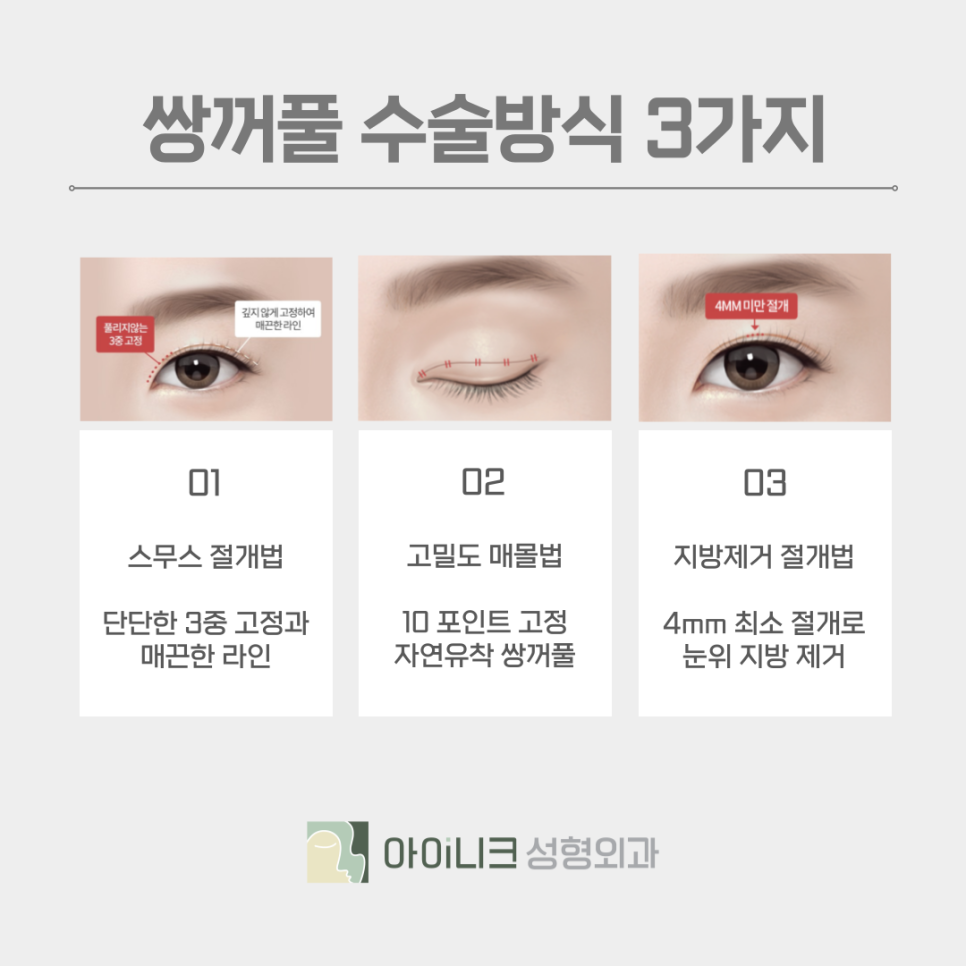 쌍꺼풀종류 본인의 눈 상태에 맞게 선택하기 관련 이미지 6