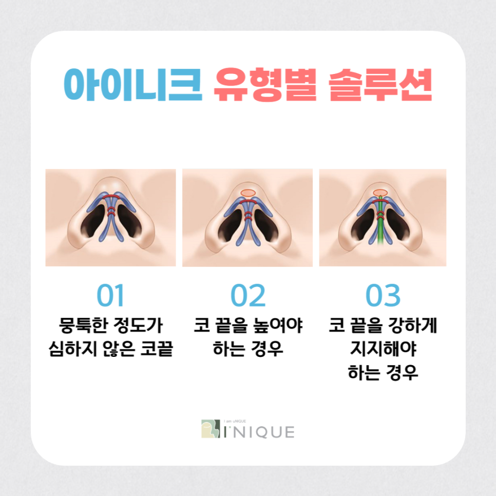 코끝성형후기가 증명하는 아이니크 관련 이미지 3