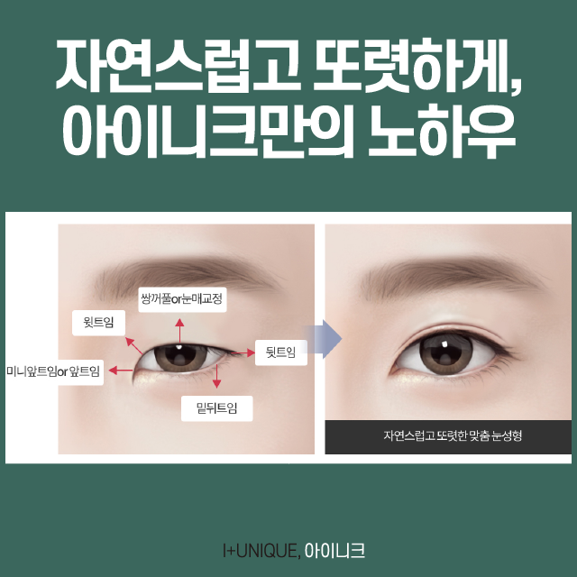 여자첫눈성형 A to Z 관련 이미지 4