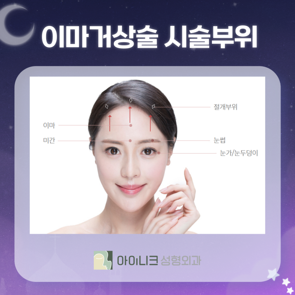 내시경이마거상술가격 후회 없는 선택하기 관련 이미지 5