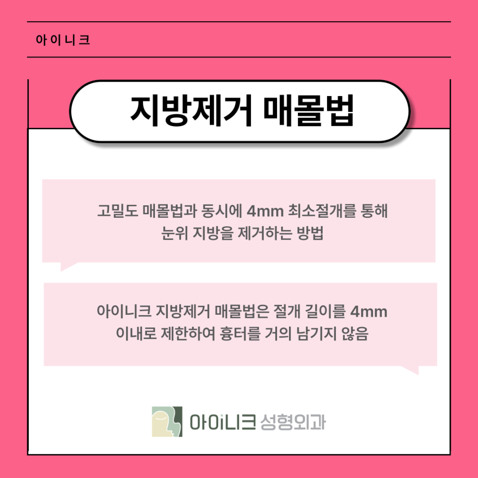 쌍꺼풀수술잘하는곳 풀릴 위험 낮은 매몰법은? 관련 이미지 8