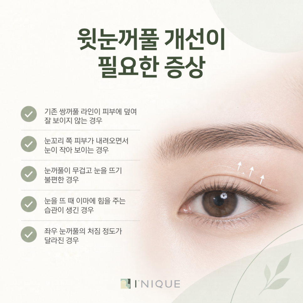 상안검수술, 권하지 않는 이유가 궁금하다면 관련 이미지 2