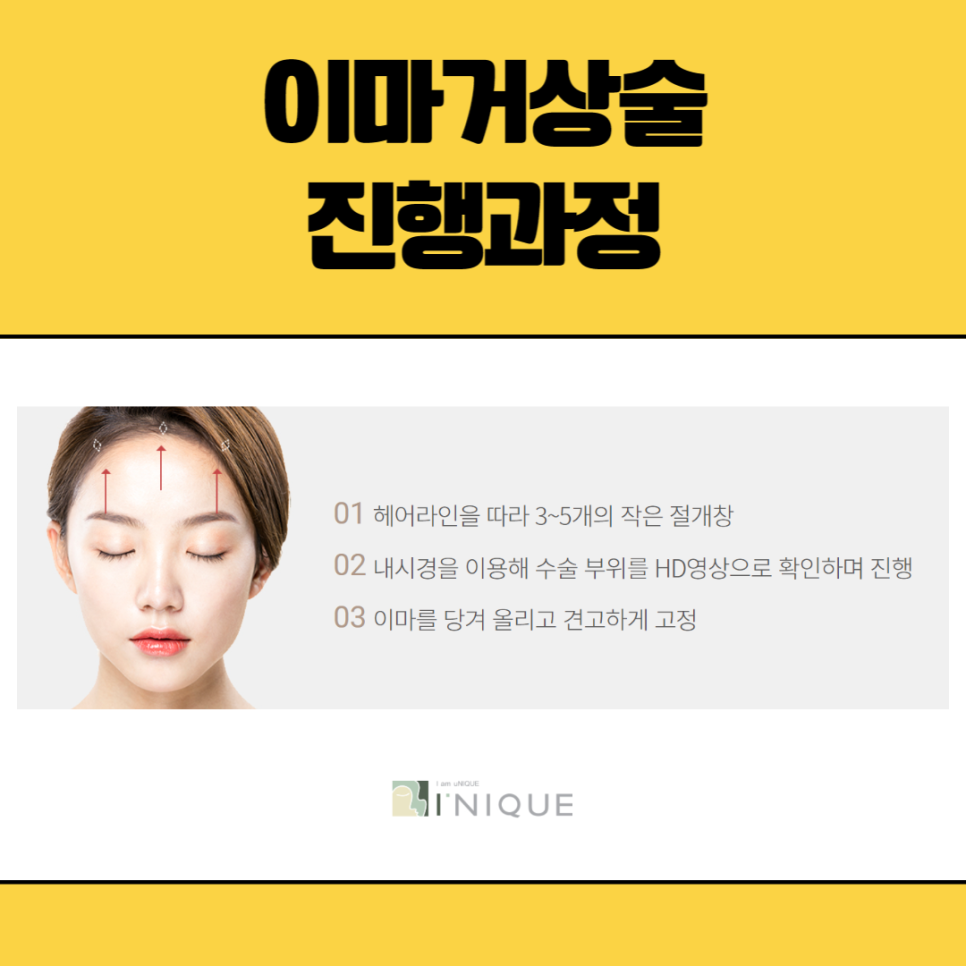 이마거상술잘하는곳 뭐가 다를까? 관련 이미지 3