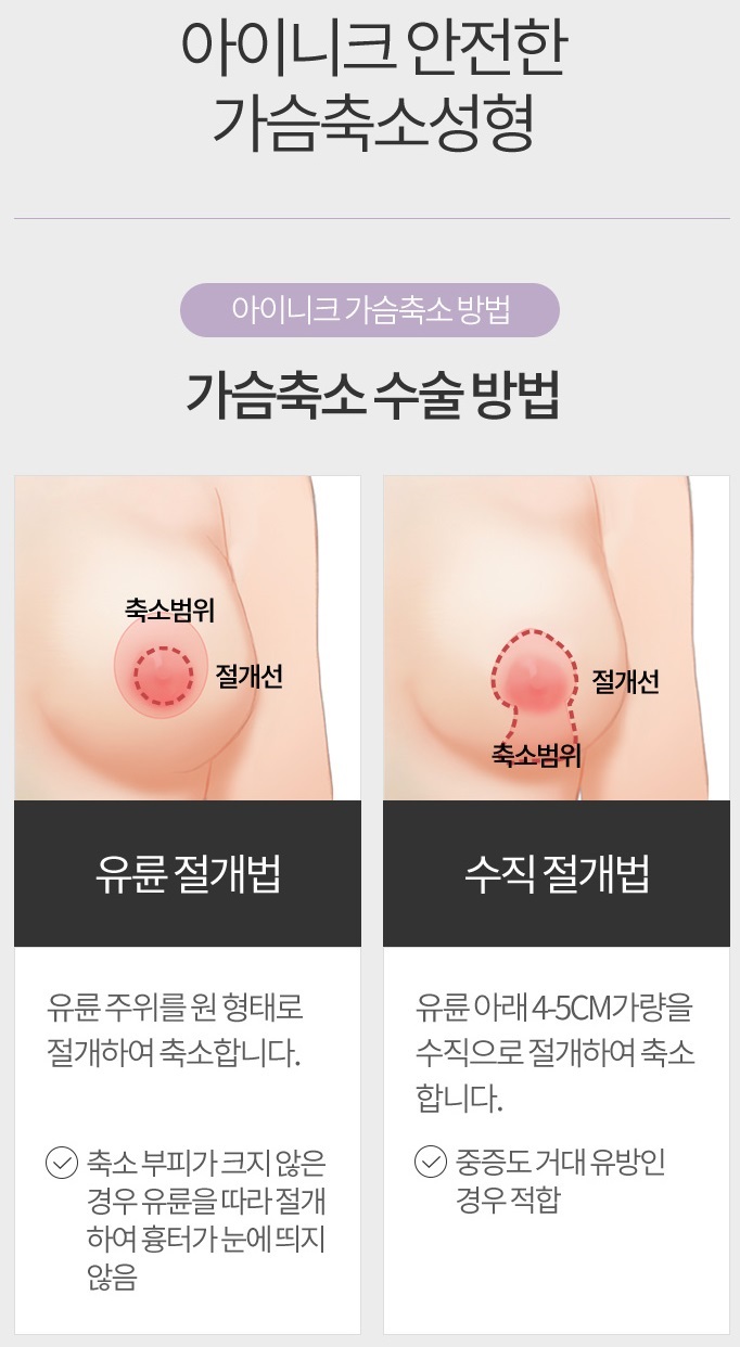가슴축소술 자연스러운 내 가슴을 위해 관련 이미지 3