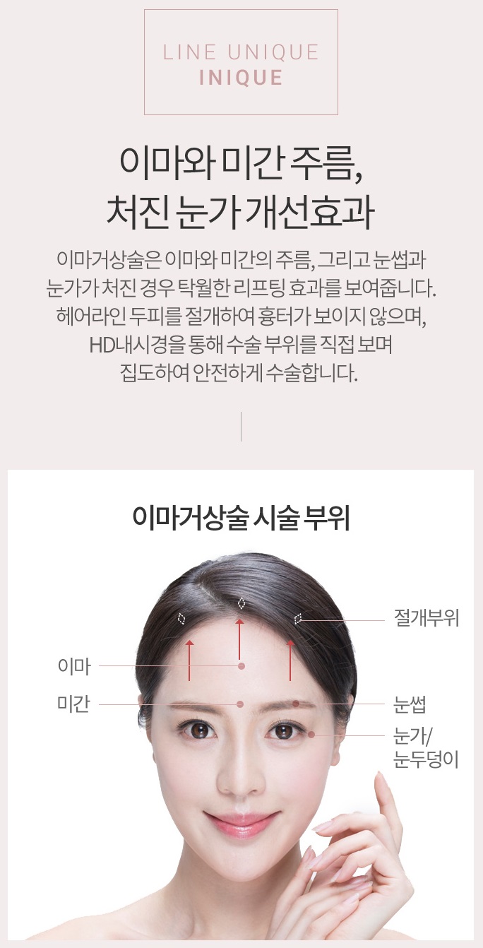 이마주름살제거 깔끔하게 예쁜 얼굴 관련 이미지 2