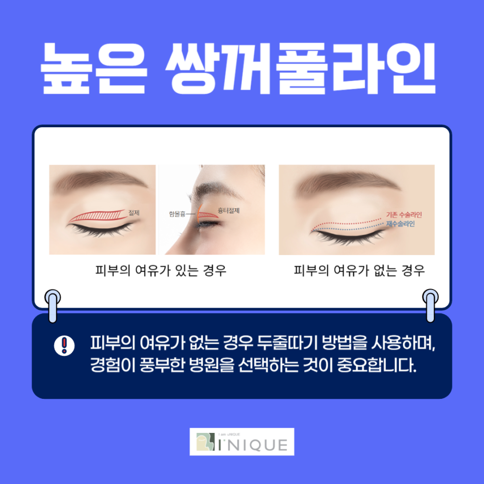Be More Careful Than Simply Looking for the Best Place for Eye Revision Surgery image 4