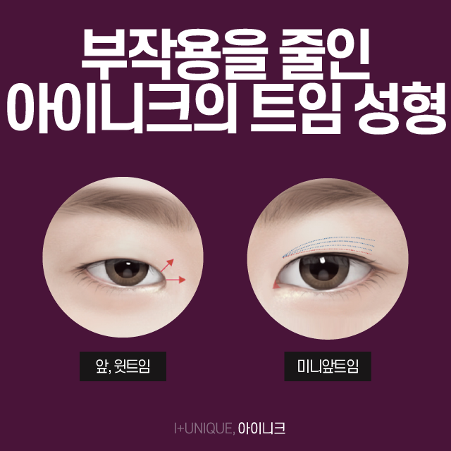 나의 눈과 어울리는 앞뒤트임을 원한다면? 관련 이미지 3