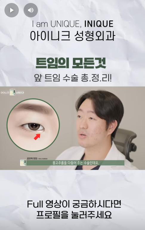 A Complete Guide to Apgujeong Epicanthoplasty!! image 2