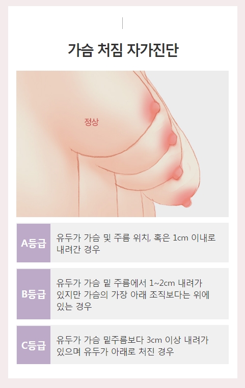 처진가슴수술비용 정확하고 꼼꼼한 맞춤 상담! 아이니크 성형외과! 관련 이미지 2