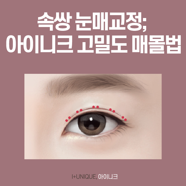 남자 눈 성형 인아웃라인 수술부터 눈매교정까지 관련 이미지 3