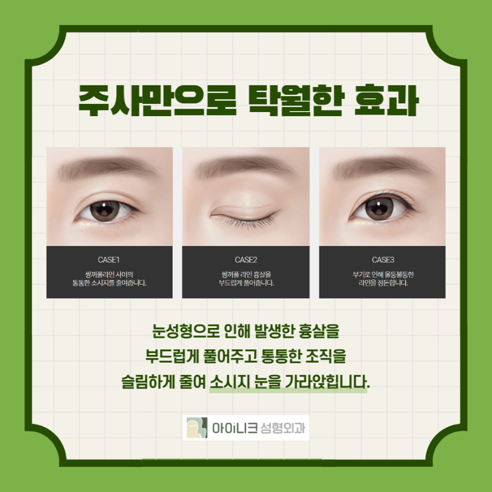 How to Easily Manage Swelling After Double Eyelid Surgery image 4
