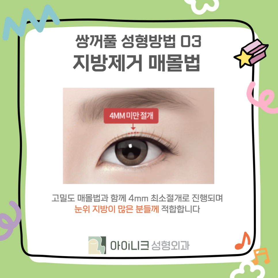 쌍꺼풀수술병원에서 알려드리는 종류와 선택 관련 이미지 12