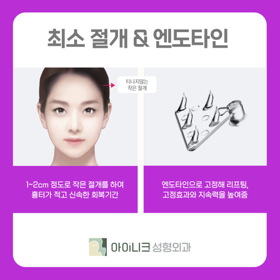 What Is Brow Lift Surgery in Apgujeong? image 6