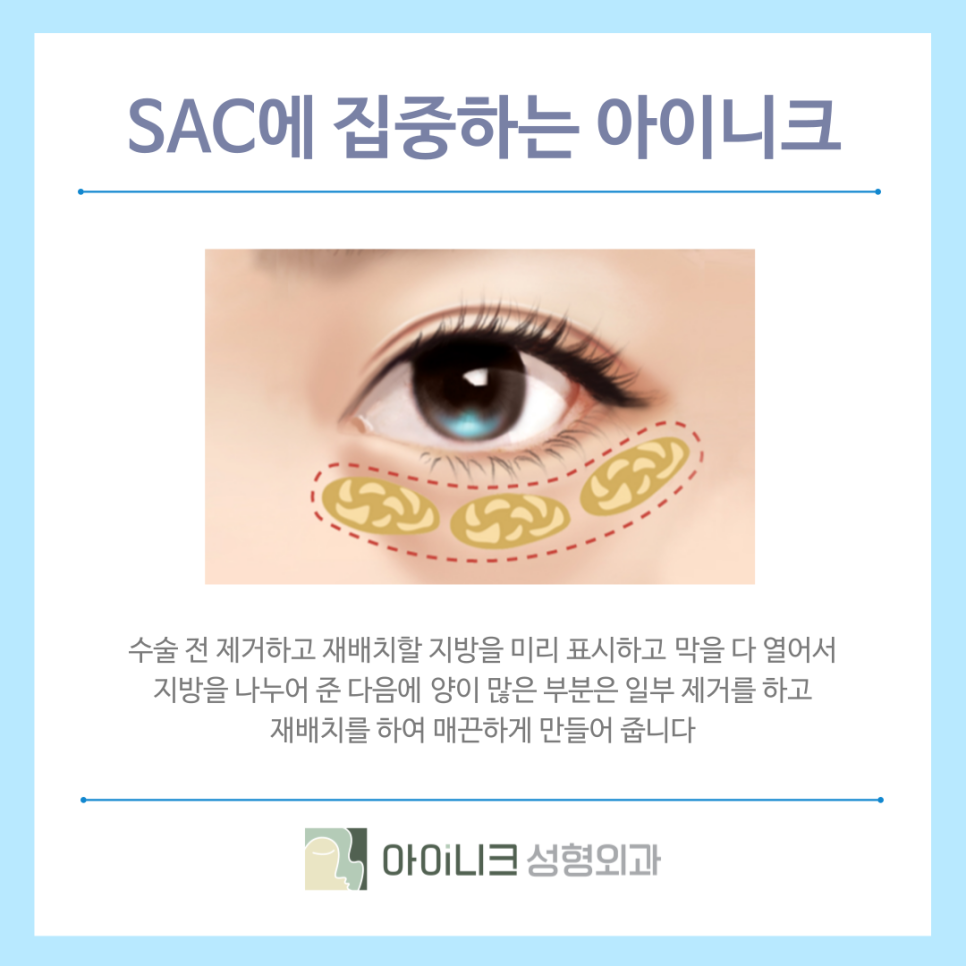 신사역근처눈밑지 동안 페이스로 만들기 관련 이미지 5