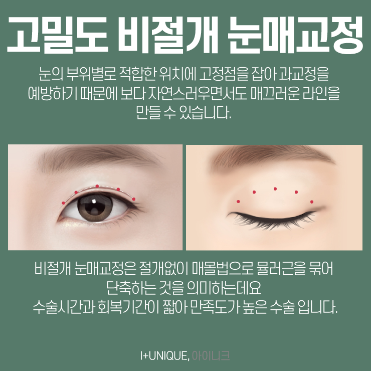 눈수술잘하는병원을 찾고 있다면 고민말고 아이니크성형외과로 관련 이미지 3