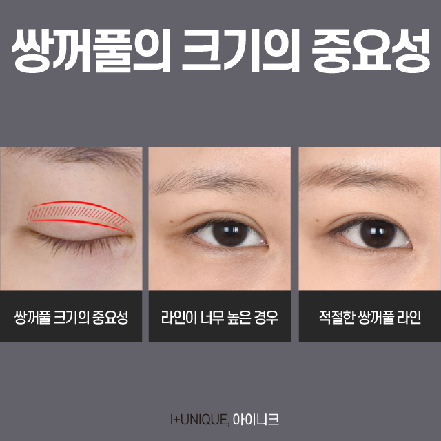 자연스러운 쌍꺼풀 만드는 비법은? 관련 이미지 2