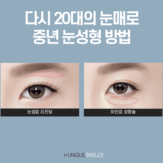 The Most Important Key Point for Successful Middle-Age Eye Surgery image 2