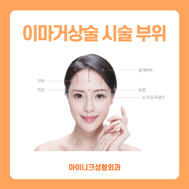Forehead Lift Surgery for Safety? Endotine image 5
