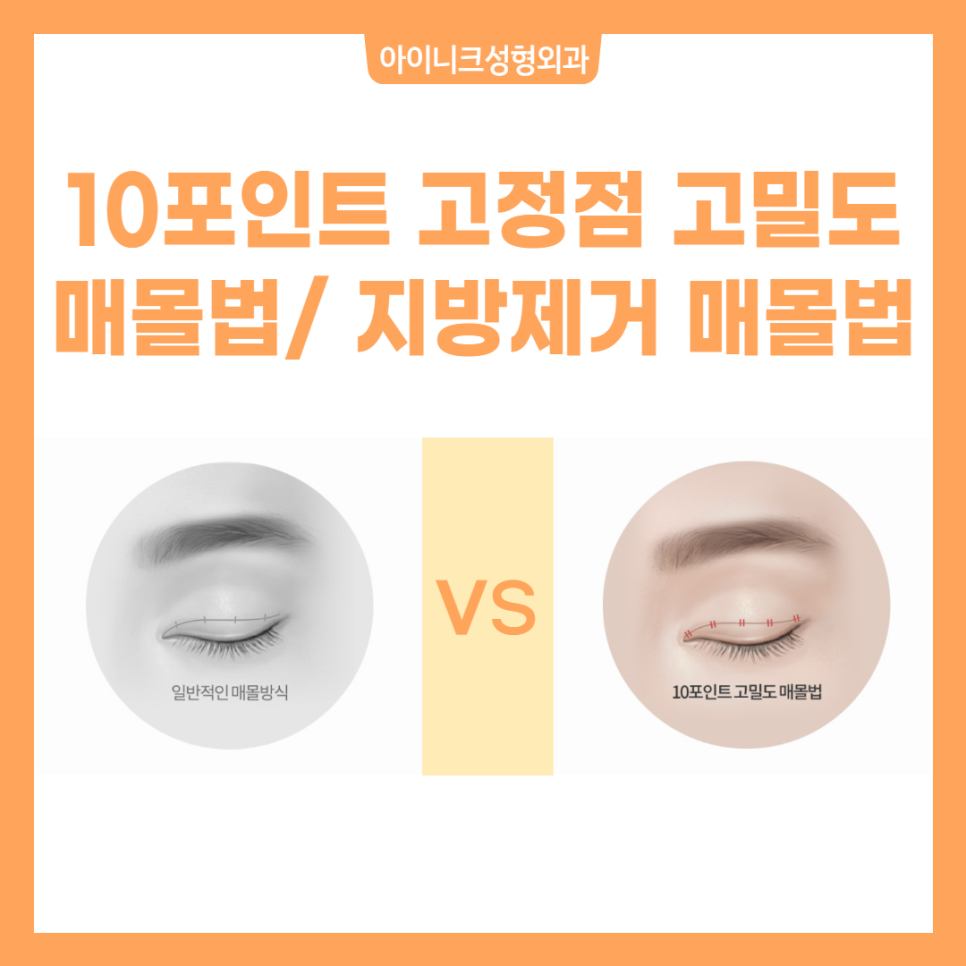 안전한 쌍수수술은 아이니크성형외과 관련 이미지 5
