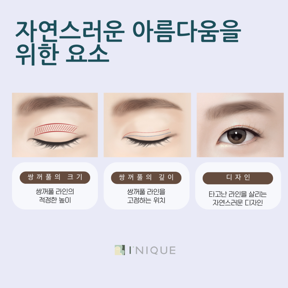 쌍수성형 잘하는 곳 선택하는 방법 관련 이미지 4