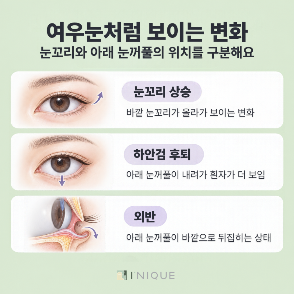 눈밑지 여우눈, 수술 후 눈매 변화의 원인과 확인할 사항 관련 이미지 3
