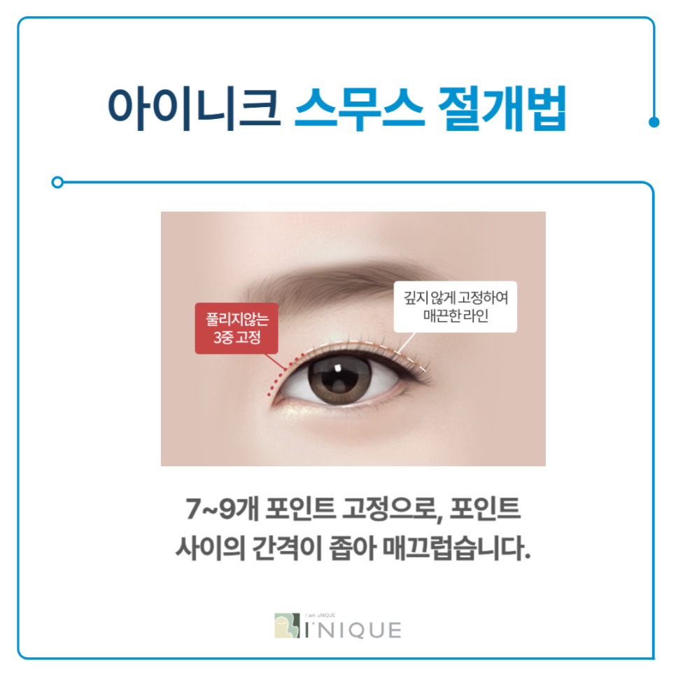 눈크게하는수술 절개법이란? 관련 이미지 4
